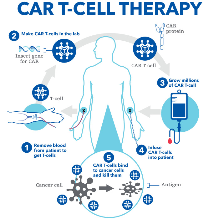 CAR T-cell therapy