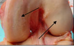 Articular Cartilage