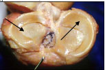 Articular Cartilage