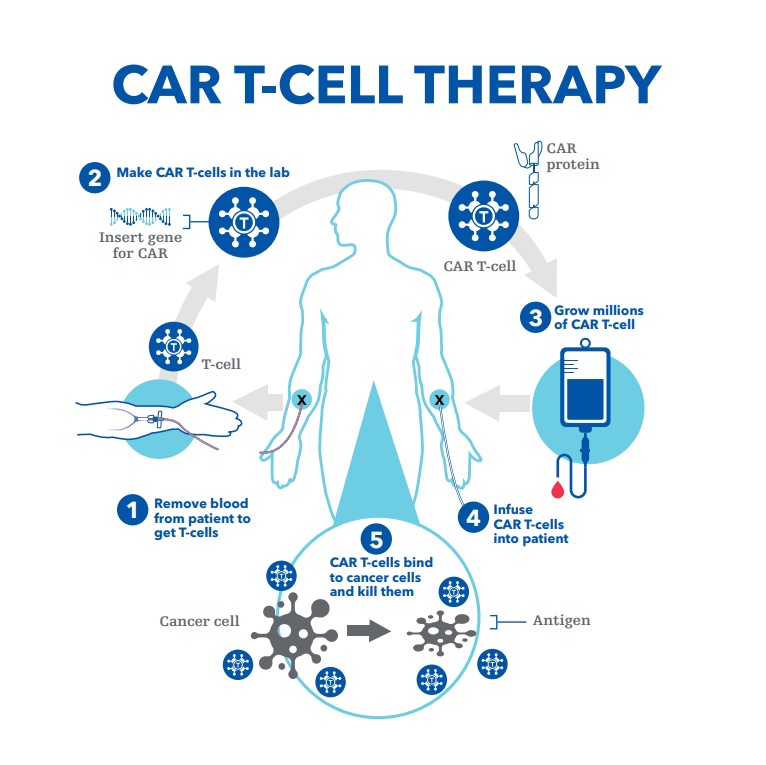 CAR T-cell therapy