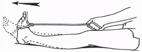 Resisted plantar flexion illustration