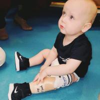 Arlo Yost sits on the floor wearing his prosthetic, and looks up at the adults seen standing around him.