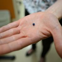 A close-up photo of the device that saved Betty’s life in the palm of her doctor’s hand.