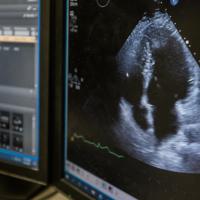 A screen displaying the echocardiogram reading that is conducted on athletes like Kenneth.