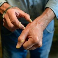 A close-up of Lynn’s hands, which have paint on them. He is using one hand to point out a span about an inch wide on his opposite thumb.