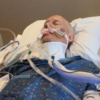 A photo of Andy lying unconscious in his hospital bed while intubated.